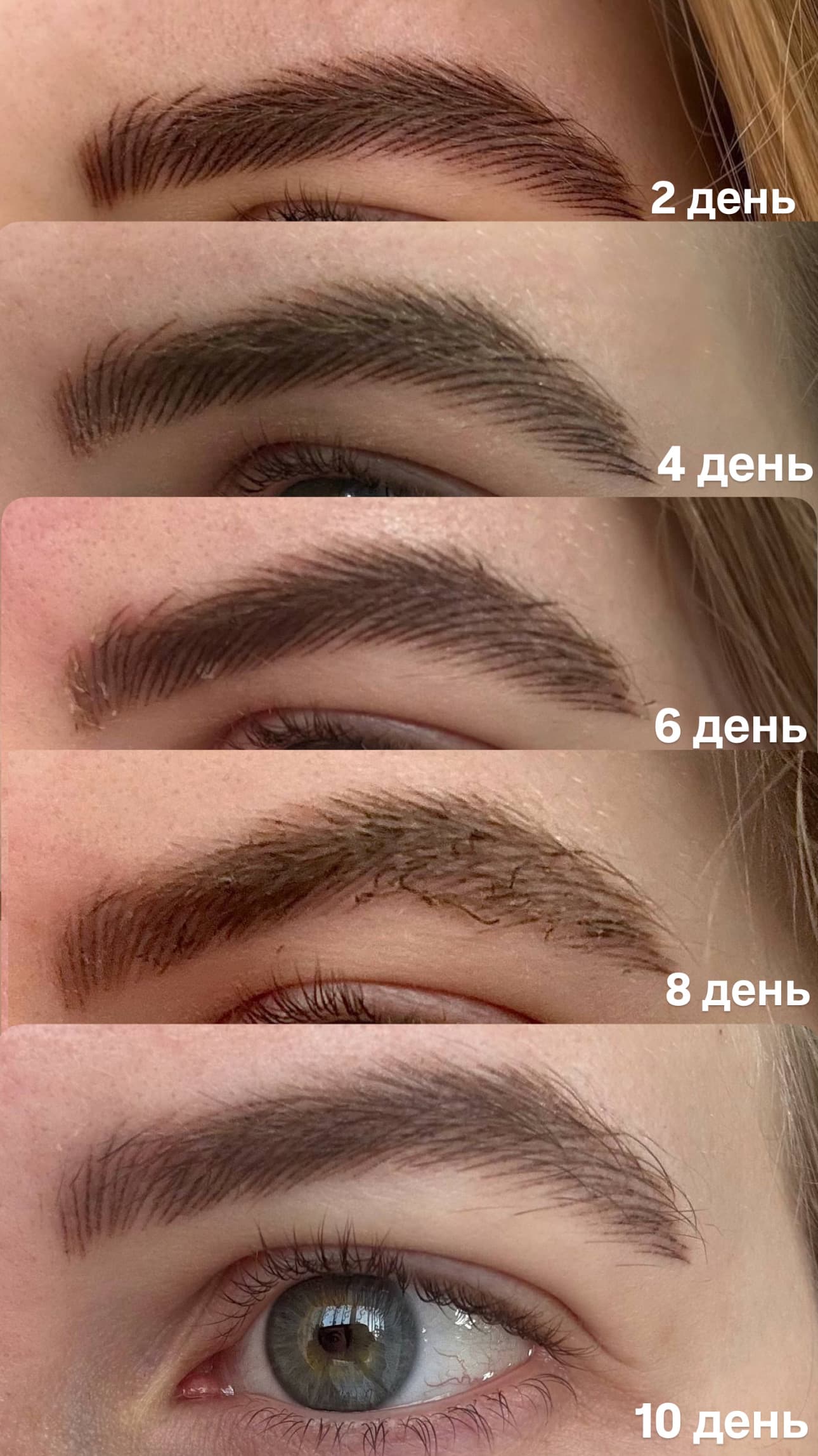 Заживление бровей по дням, 2, 4, 6, 8, 10 день